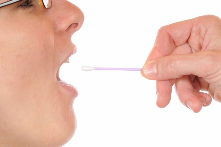 Bei einem DNA-Test werden Gewebe und Speichel mit einem Abstrich der Mundschleimhaut per Wattestäbchen entnommen, dann wird ein genetischer Fingerabdruck erstellt. Foto: PeJo - Fotolia. com