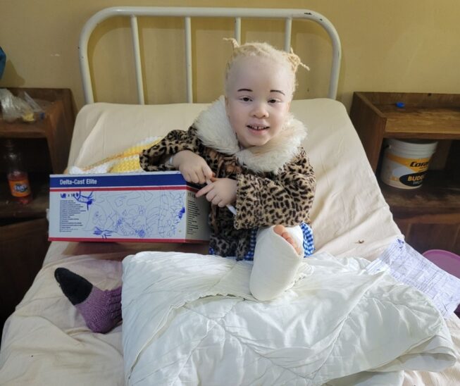 Das fünfjährige Mädchen mit Albinismus nach ihrer X-Bein-Korrektur.