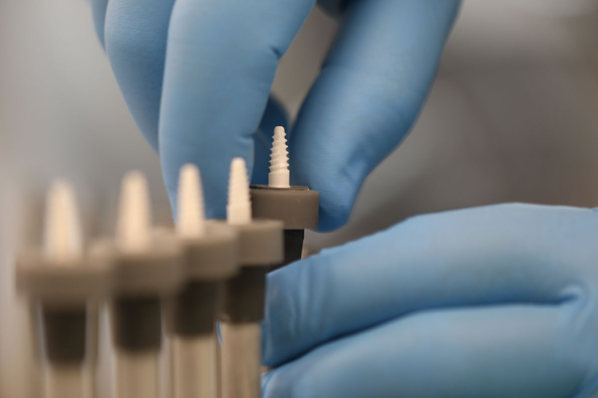Zahnimplantate aus dem CeramTec-Dentalbereich der Medizintechnik.